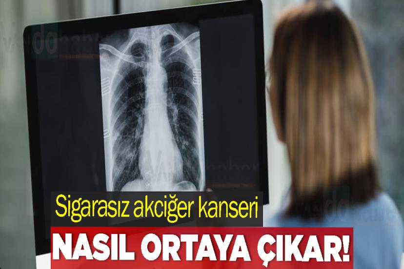 Sigarasız akciğer kanseri vakalarında dikkat çeken artış
