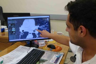 Kansersin, astımsın dediler: Akciğerinden kabak çekirdeği çıktı