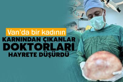 Van’da bir kadının karnından çıkanlar doktorları hayrete düşürdü
