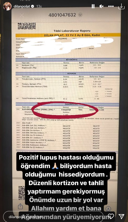 Dilan Polat, Lupus hastalığına yakalandı