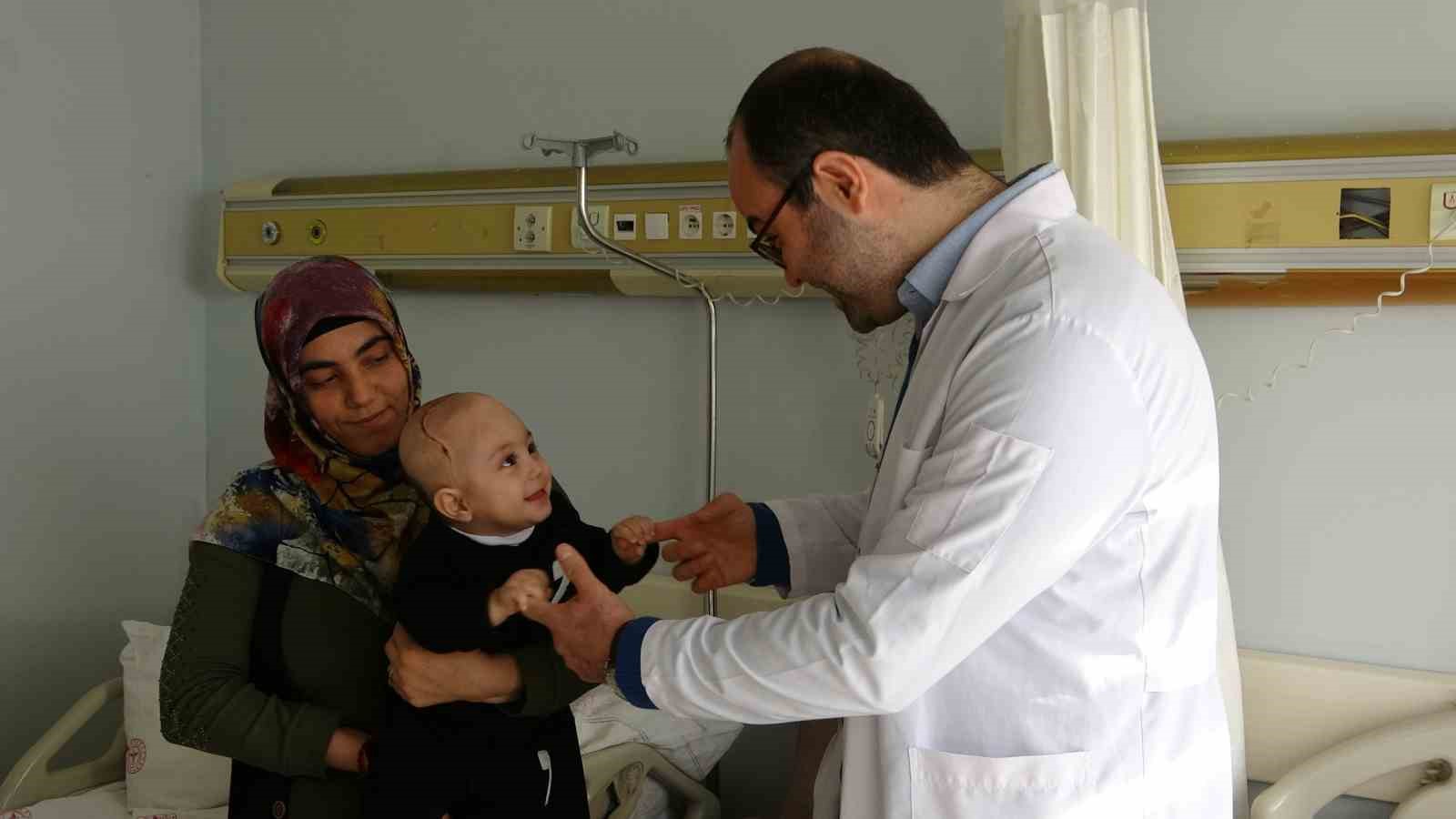 Kafatasında şekil bozukluğu olan 7 aylık bebek ameliyat edildi