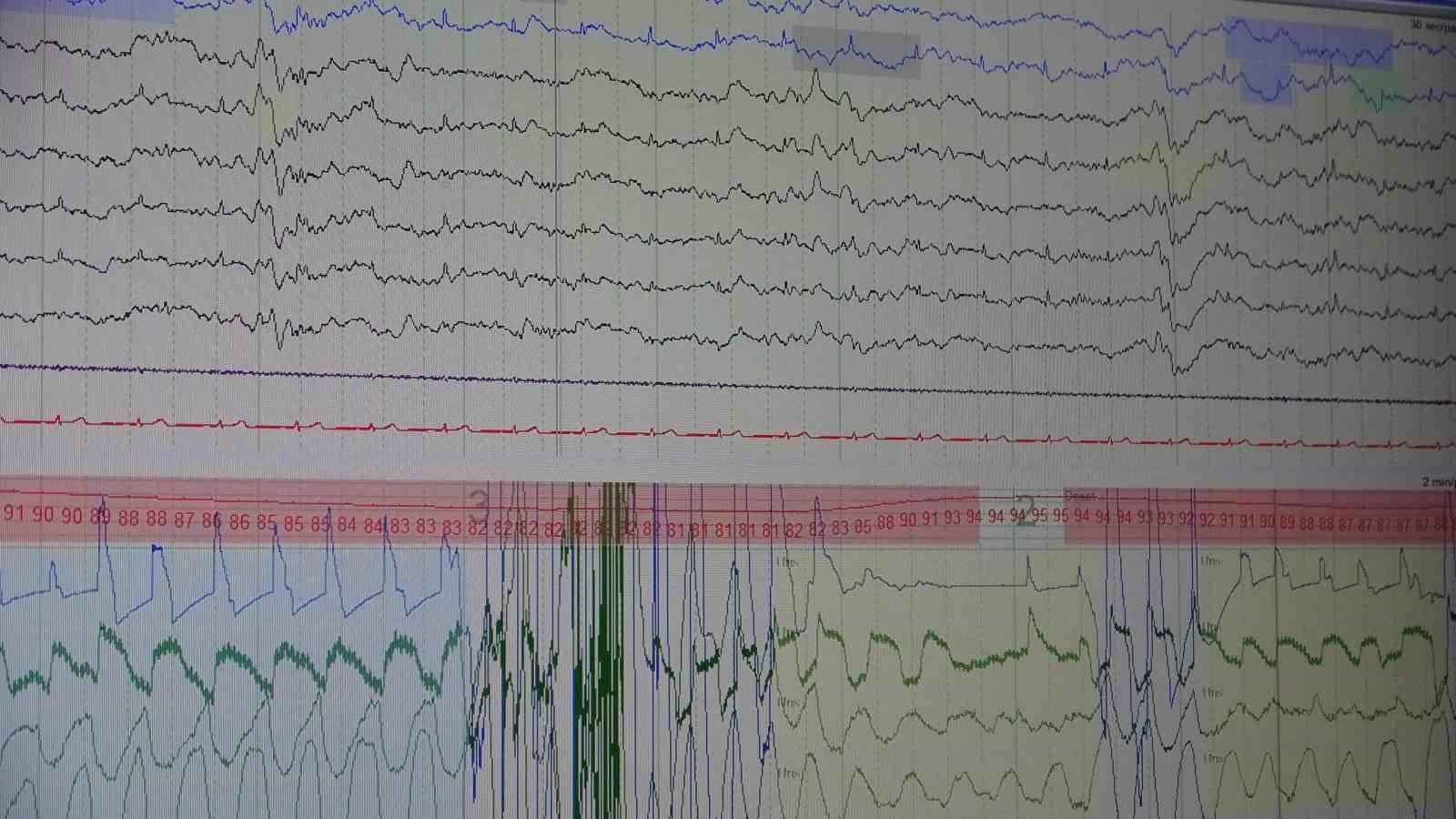Van’da bir ilk: Yapay zeka ile uyku apnesi tespiti