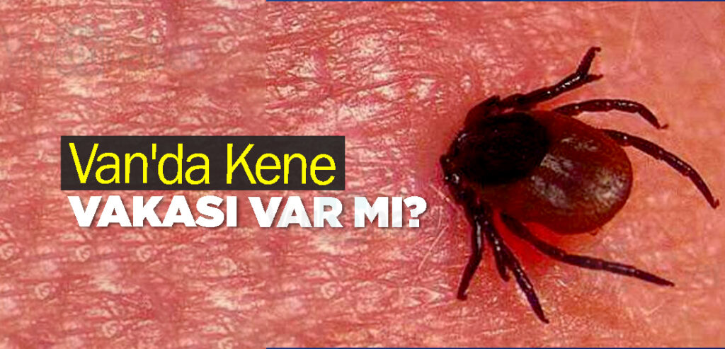 Van'da Kene Vakası Var mı?