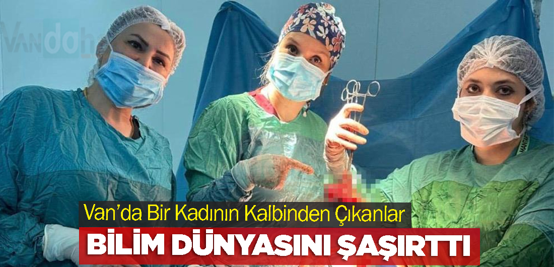 Van’da Bir Kadının Kalbinden Çıkanlar Bilim Dünyasını Şaşırttı